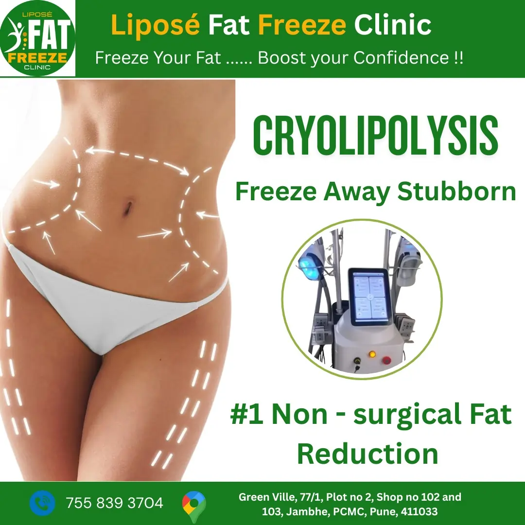cryolipolysis |Liposé Fat Freeze Clinic