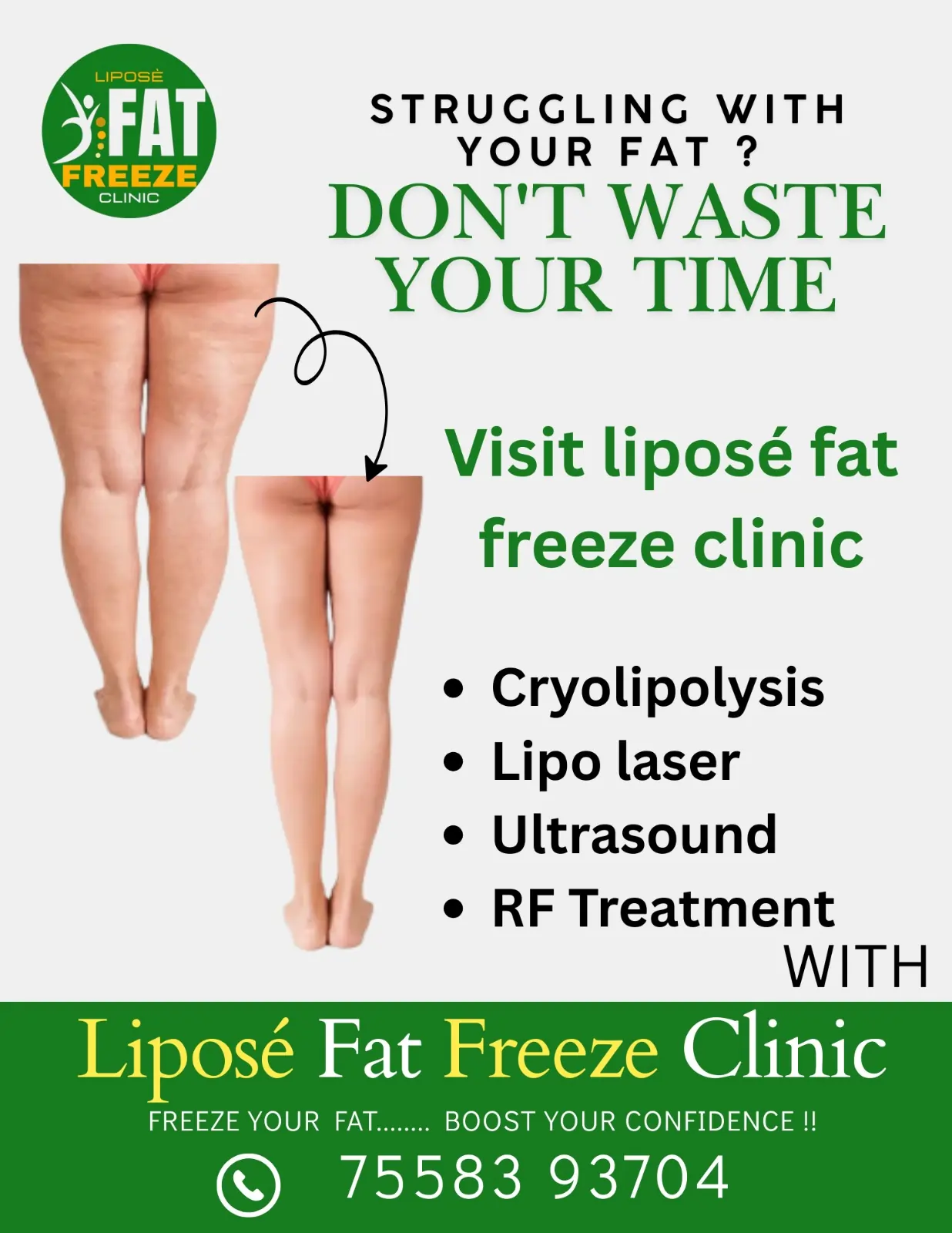 struggling-with-your-fat-do-not-waste-your-time |Liposé Fat Freeze Clinic