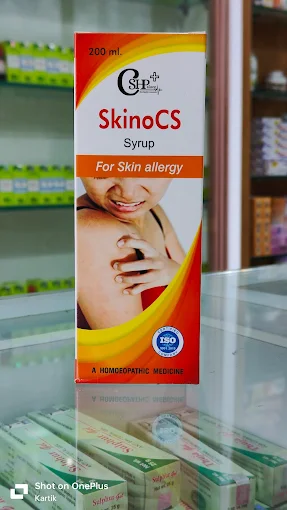 skinocs-homoeopathic-medicine-for-skin-allergy |C.S.Homoeo Medicose